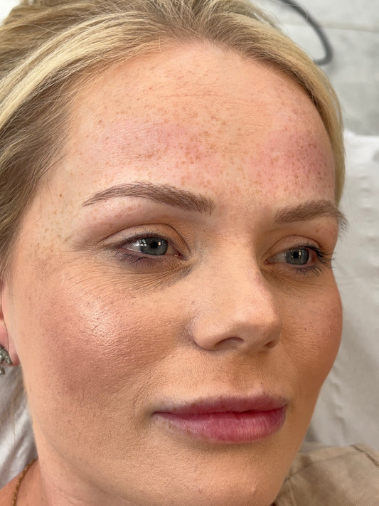 Microblading including top up